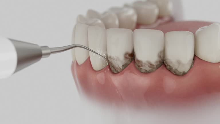 Reliable Dental Implants contractor in Pennington Gap, VA by Smile Center Dentistry